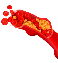 Cholesterol Management