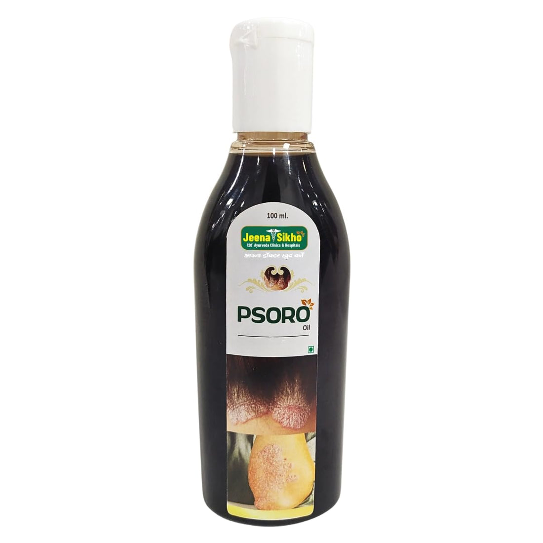 Psoro Oil | For Skin Wellness, 100ml